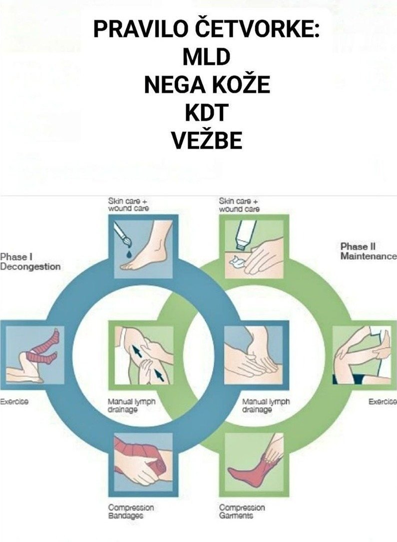 Pravilo četvorke: MLD, nega kože, KDT i vežbe — faza I (dekongestija) i faza II (održavanje)